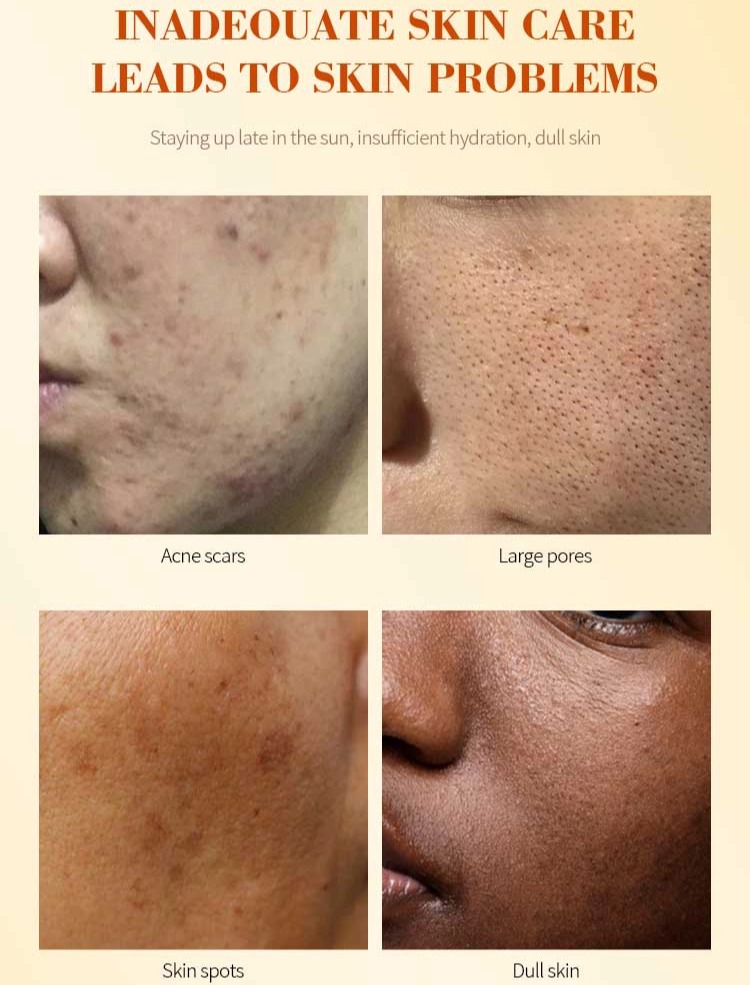 Turmeric & Kojic Cleansing Set