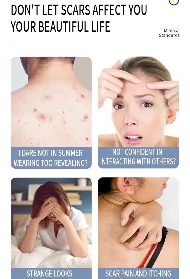 Acne Scar Gel Salicylic Acid