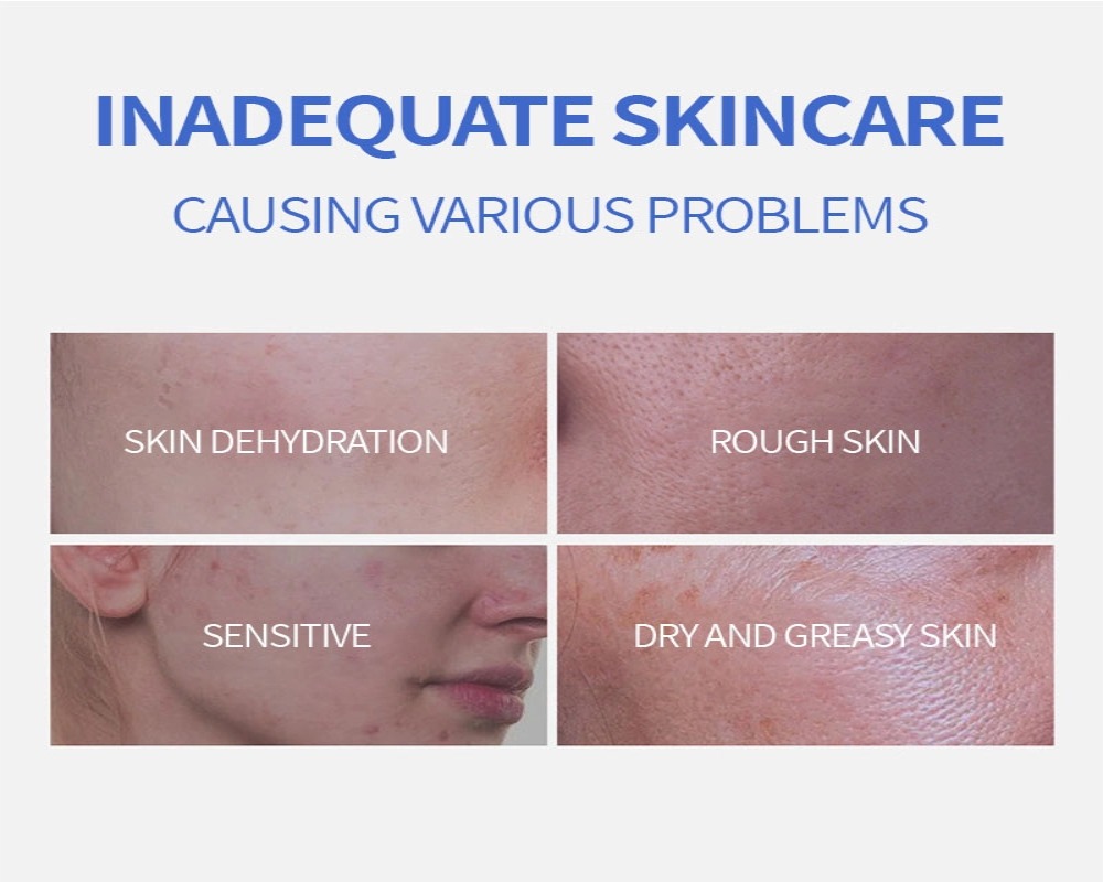 applying dark spot correction cream on face